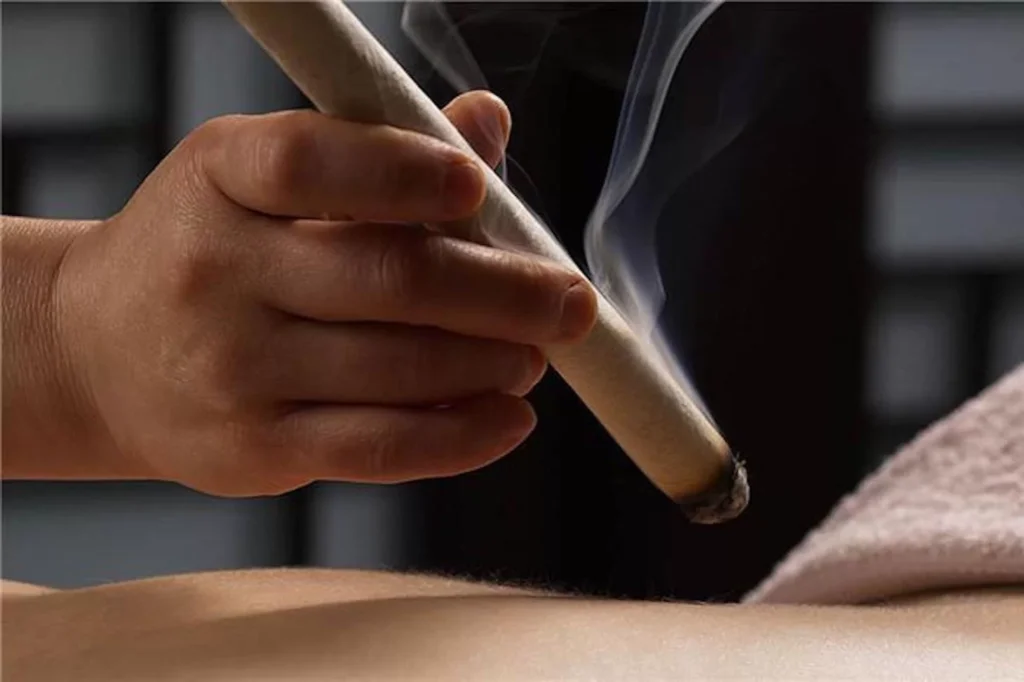 Acupuncture Mississauga near me moxibustion Acupuncture near me Mississauga Moxibustion therapy to replace needles