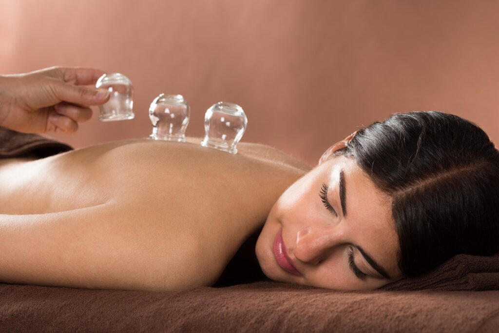 acupuncture cupping Acupuncture cupping