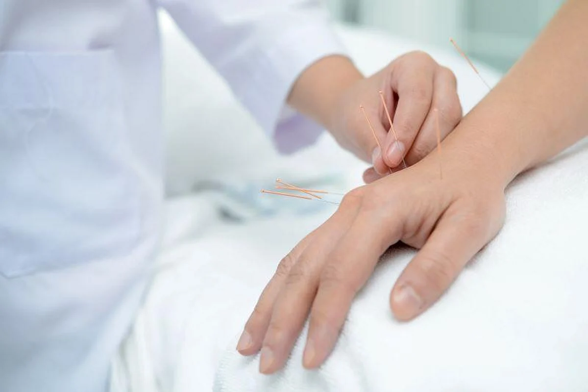 Acupuncture Mississauga for neck Shoulder sprain strain pain
