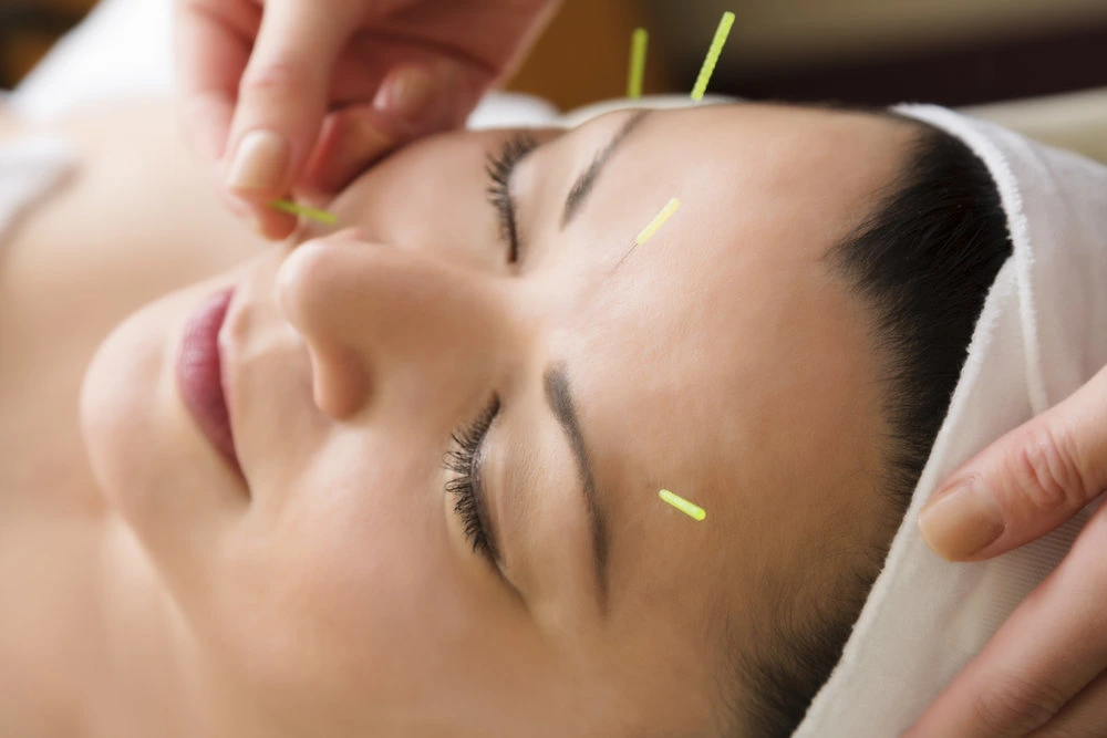 facial acupuncture near me