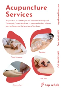 Top Rehab Acupuncture Flyer introduction and benefits